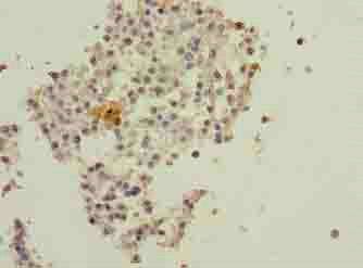 DNAL4 Antibody