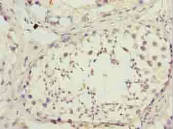 DNAL4 Antibody