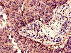 DNM1L Antibody