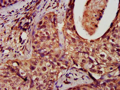 DNM1L Antibody