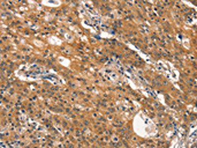 DNM2 Antibody