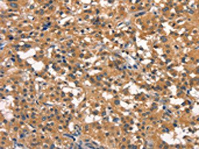 DNM2 Antibody