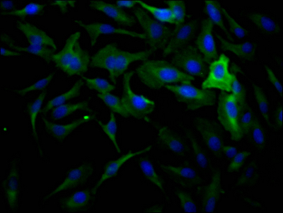 DNM2 Recombinant Monoclonal Antibody
