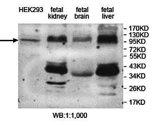 DNMT3A Rabbit Polyclonal Antibody