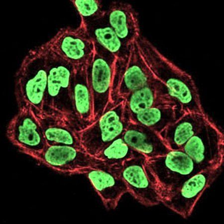 DNMT3B Antibody