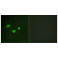 DNMT3B Antibody