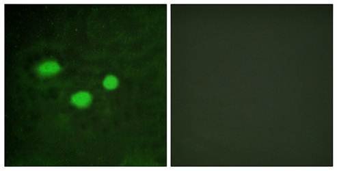 DNMT3B Antibody