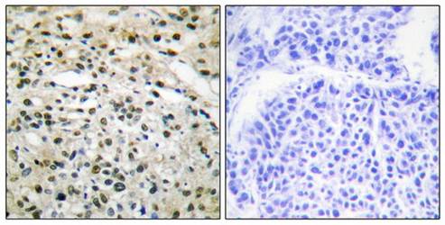 DNMT3B Antibody