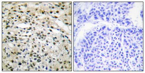 DNMT3B antibody