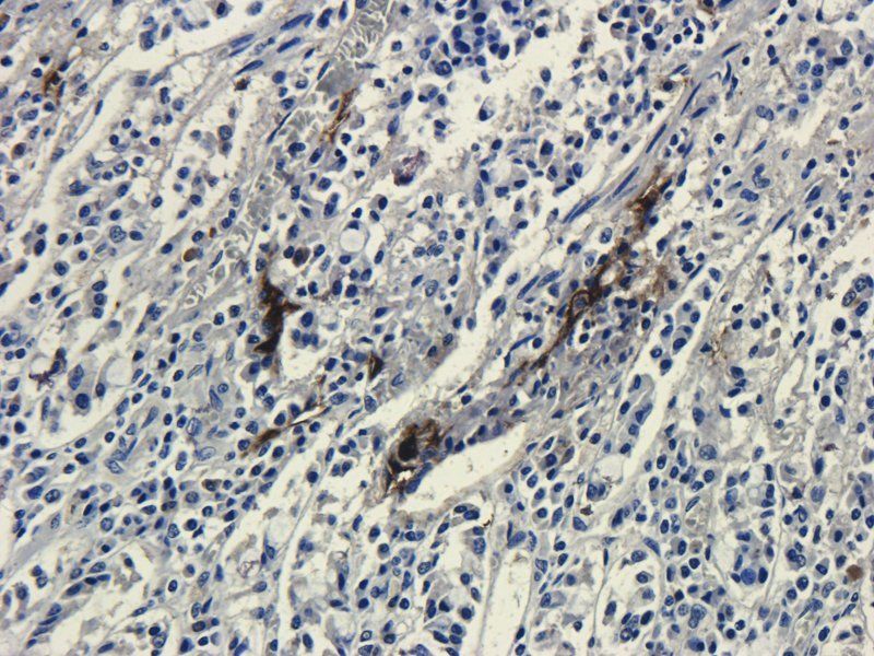 Dnmt3b antibody