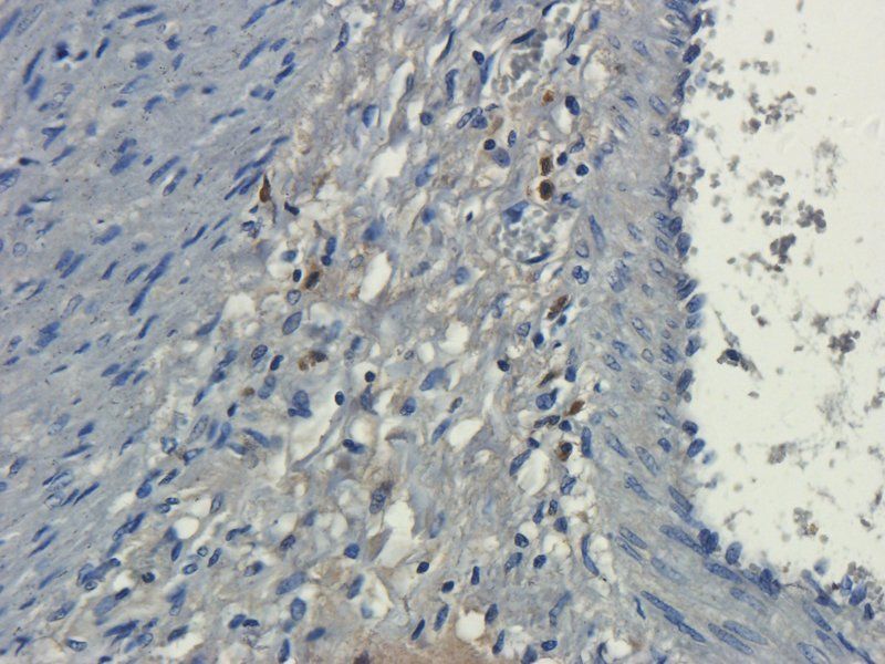 Dnmt3b antibody