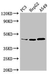 DNMT3L Antibody