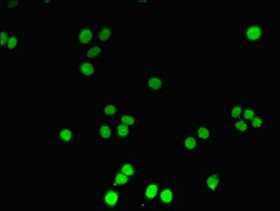 DNTT antibody