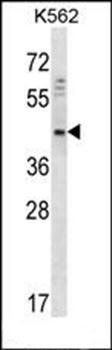 DOC2A antibody