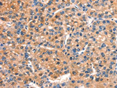 DOCK1 Antibody