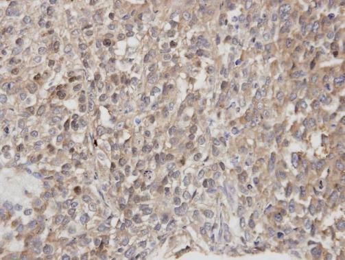 DOCK1 antibody