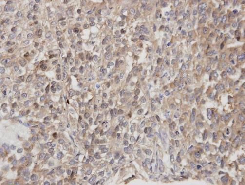 dedicator of cytokinesis 1 Antibody