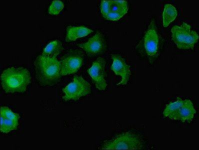 DOCK8 Antibody