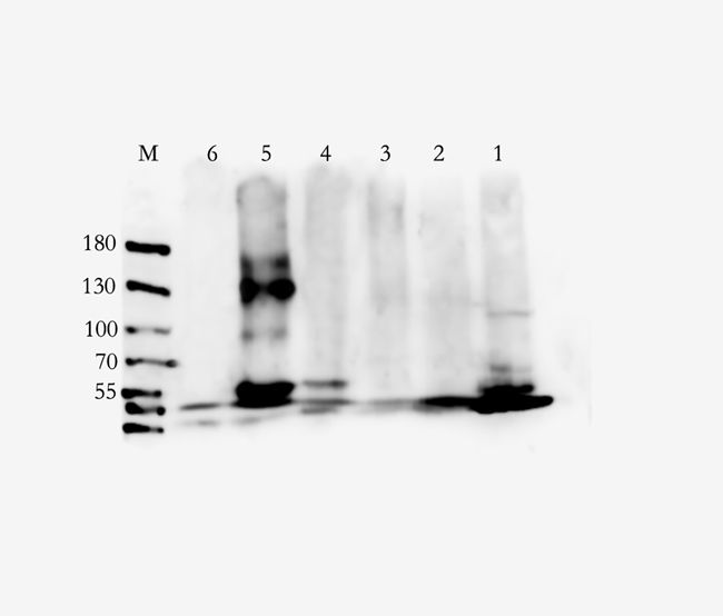 DOCK8 antibody