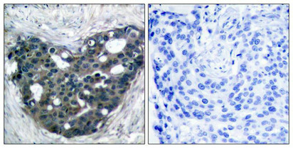 DOK2 (Ab-299) Antibody