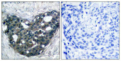 DOK2 (Ab-299) antibody