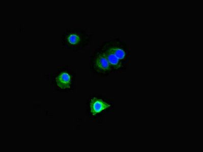 DOK2 Antibody