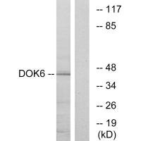 DOK6 Antibody