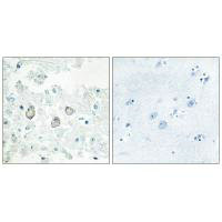 DOK7 Antibody