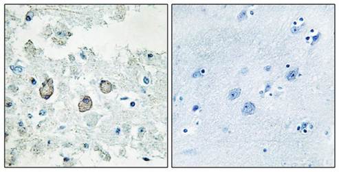 DOK7 Antibody