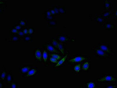 Dolichyl-diphosphooligosaccharide-protein glycosyltransferase subunit DAD1 antibody