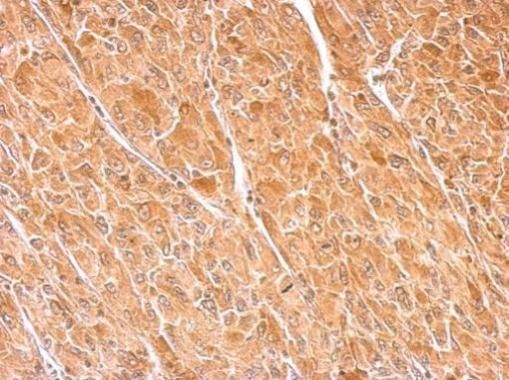 Dopamine beta Hydroxylase antibody