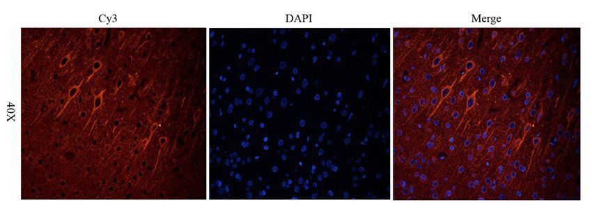 Dopamine D2 receptor antibody