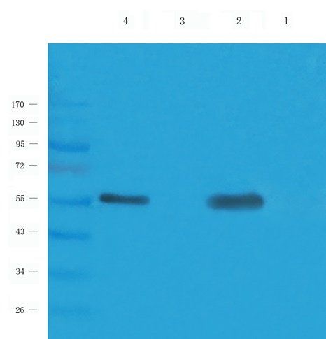 Dopamine D2 receptor antibody