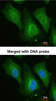 Dopamine beta-Hydroxylase antibody