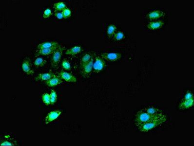 DCX Antibody