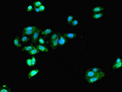 Doublecortin antibody