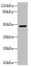 Doublecortin antibody