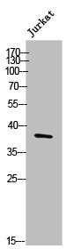DCX Antibody