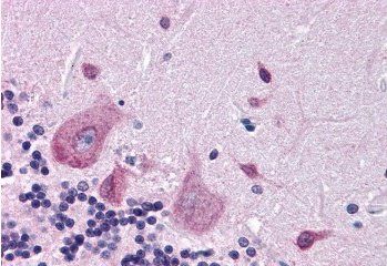 Goat anti-Dipeptidylpeptidase 10 Antibody