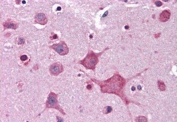 Goat anti-Dipeptidylpeptidase 10 Antibody