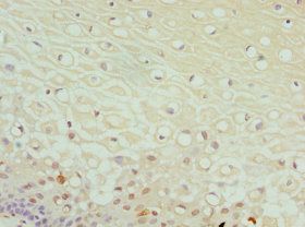 DPP3 Antibody