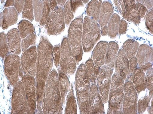 DPP3 antibody [N2C1], Internal