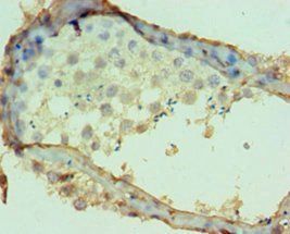 DPP7 Antibody