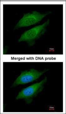 DPRP1 Rabbit Polyclonal Antibody