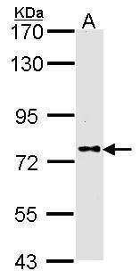 DPRP1 Rabbit Polyclonal Antibody