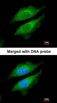 DPRP1 antibody