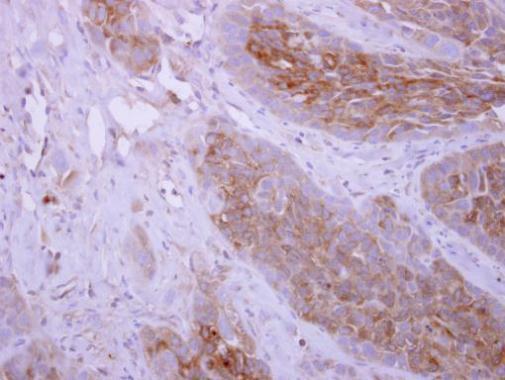 dihydropyrimidine dehydrogenase Antibody