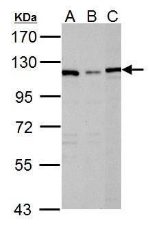 DPYD antibody