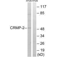 DPYSL2 (Ab-509) antibody