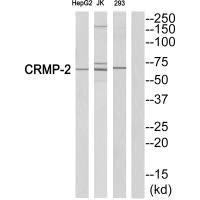 DPYSL2 (Ab-522) antibody